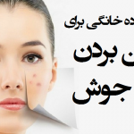از بین بردن جای جوش با ۵ درمان خانگی