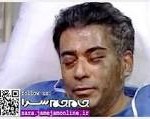اسیدپاش معتاد چهار نفر را مجروح کرد