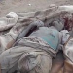 جنایات وحشتناک سعودی ها در یمن (۱۸+)