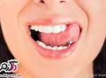 آیا تورم زبان کوچک، علت خرخر شبانه است؟
