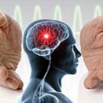 چگونه پس از سکته مغزی زنده بمانیم