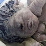 یک نوزاد عجیب الخلقه در مصر متولد شد عکس