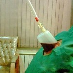 هر آنچه درباره حجامت باید بدانید
