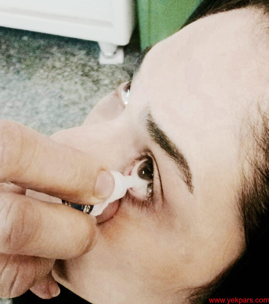 روش درست استفاده از قطره های چشمی روش درست استفاده از قطره های چشمی