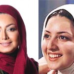 بازیگران ایرانی، قبل از عمل بعد از عمل +تصاوير