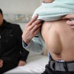 مردی که سینه اش قلب ندارد+ عکس