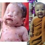 نجات نوزادی که با ۱۴ ضربه چاقو زنده به گور شده بود +عکس