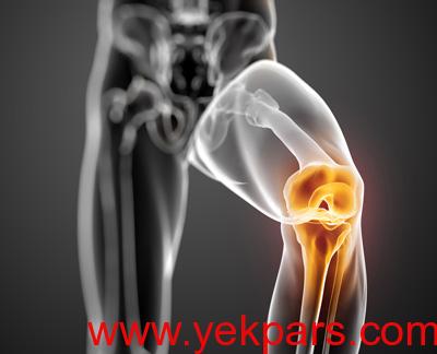 علائم آرتروز, علائم آرتروز زانو