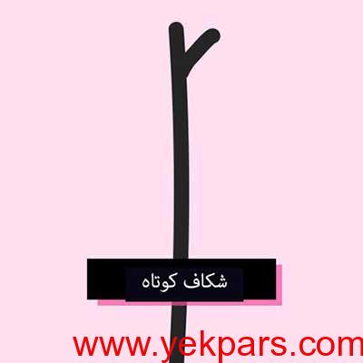 درمان موخوره