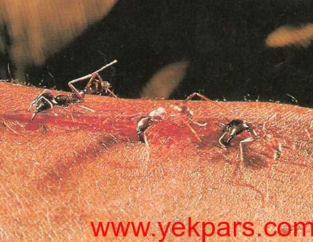 مورچه های عجیبی که بخیه جراحی میزنند +عکس