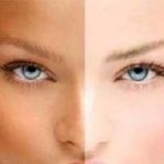 تغییر رنگ پوست ایا ضروری است؟
