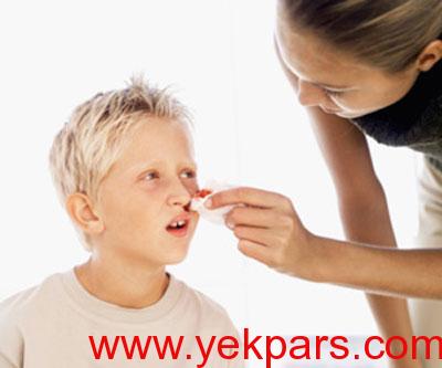 دلیل خونریزی بینی , درمان خونریزی بینی