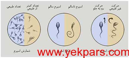 تفسیر آزمایش اسپرم