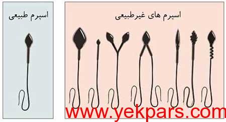 شرایط آزمایش اسپرم