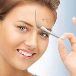 قربانیان جوش و آکنه بخوانند