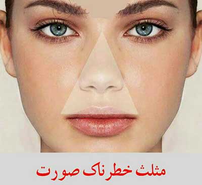 از بین بردن جوش صورت