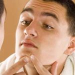 آکنه صورت تان را با این روشهای طبیعی بدون ضرر از بین ببرید