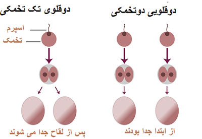 چگونگی دوقلو باردار شدن,بارداری دو قلویی