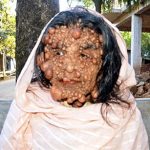 زشتترین و وحشتناکترین چهره زن دنیا