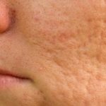 با کنترل این ماده خوراکی چهره ای جذاب با اعتماد به نفس بالا داشته باشید