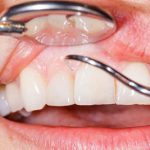 دندانهای برخی از بیماریها را داد میزنند