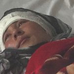 گوشهای این زن توسط شوهرش بریده شد+عکس
