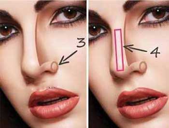 عکس انواع بینی
