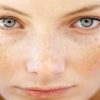 ۶ توصیه برای داشتن پوستی صاف و بدون لک