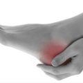 خار پاشنه را چگونه درمان کنیم؟