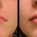 روش هایی برای برجسته کردن لب