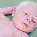 چه کنیم بچههایمان زال (آلبینیسم) نشوند؟