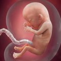 علت پارگی کیسه آب جنین در بارداری چیست و چه علائمی دارد؟