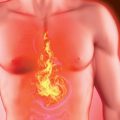 چه غذاها و نوشیدنی هایی برای سوزش سر دل مناسب است؟
