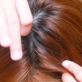 همه چیز درباره شپش