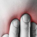 آبسه لثه چیست و چگونه درمان می شود؟