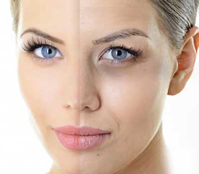 روشهای سریع برای رهایی از سیاهی و پف زیر چشم