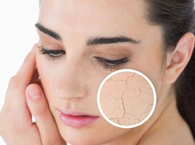 6 مشکل رایج خشکی پوست