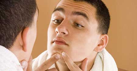 آکنه صورت تان را با این روشهای طبیعی بدون ضرر از بین ببرید