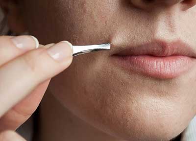 چگونه می‌توان رشد موی زائد را به تاخیر انداخت؟