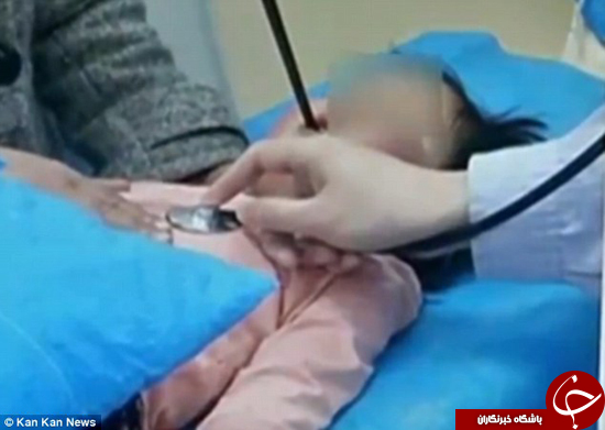 رفتن چوب غذا در دهان دختر چینی تا یک میلیمتری مغزش