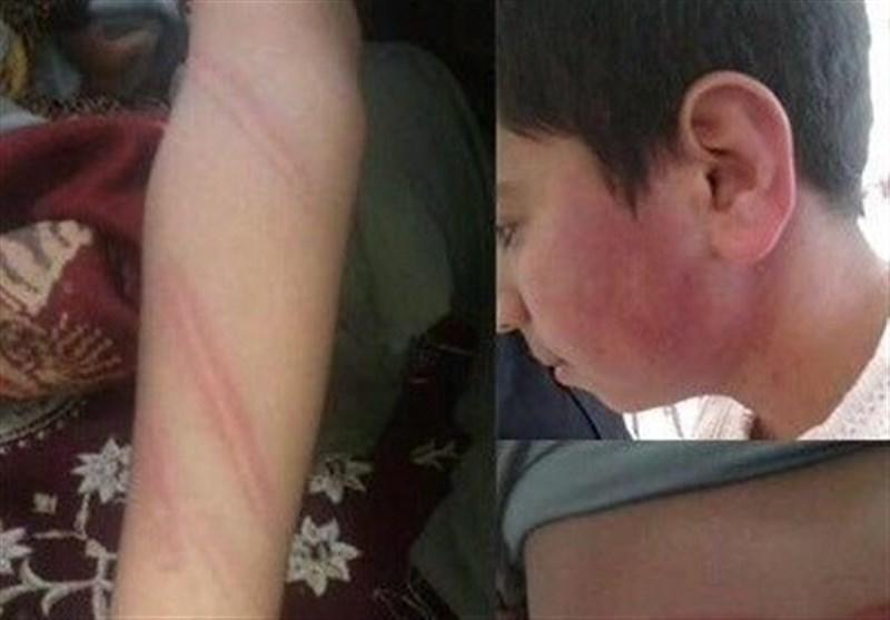 کتک خوردن  نوبت دانش‌آموزان  شهر قائنات خراسان جنوبی+عکس