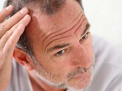 نقش استرس در سفید شدن موها