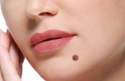 آیا همه خال ها برای نمونه برداری باید برداشته شوند؟